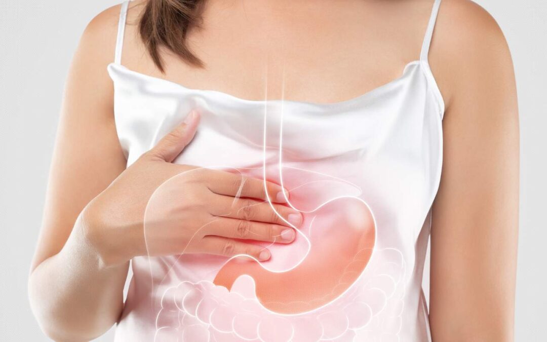 Reflux