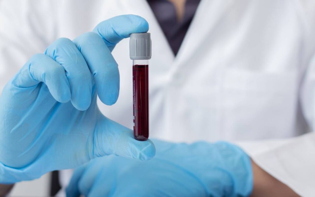 Anemia – Diagnosis & Treatment