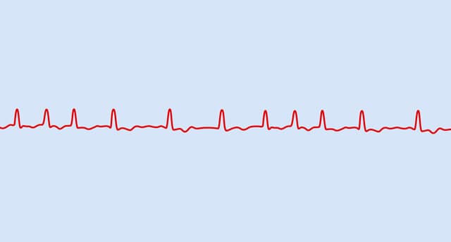 atrial fibrillation